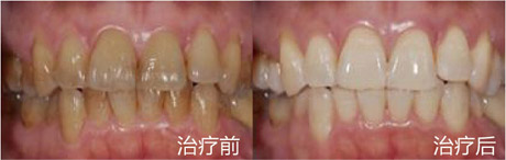 1448507545443394.jpg 1448507545443394.jpg