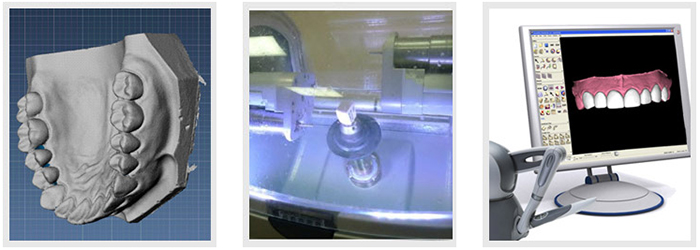 美奥口腔3D设备 美奥口腔3D设备