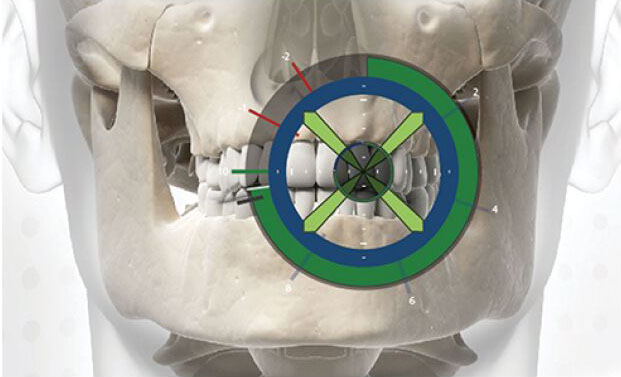 1511142403759959.jpg 高精定位牙齿位置.jpg